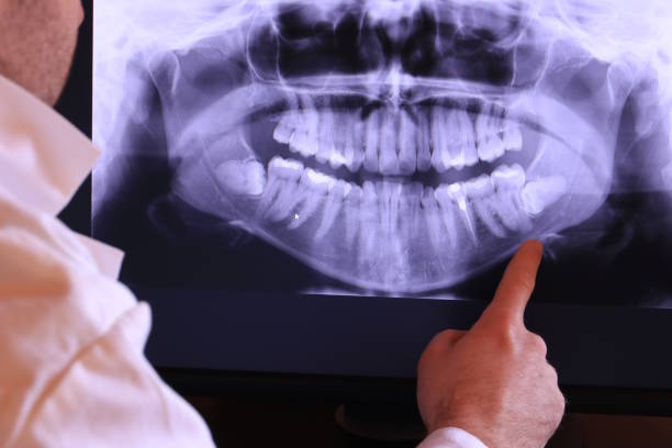 Best Orthodontic Emergency Dentist in Sand Lake, MI