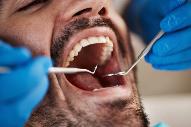 Best Mobile Emergency Dentist in Sand Lake, MI